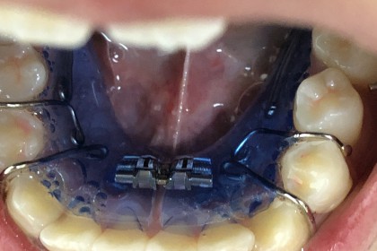 28E69D7B-6D63-420B-A2F7-F3FEBB065778