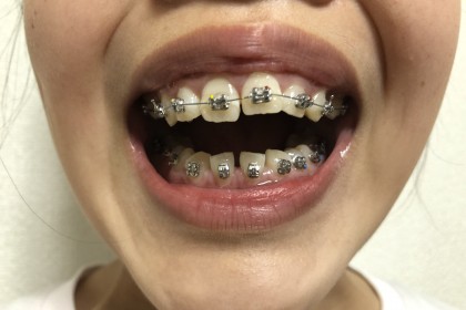 9C3865A3-7C7F-4AB2-844F-2AC0E707DAEA