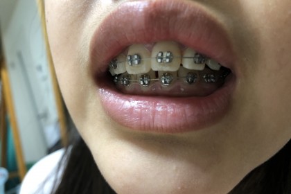 BF67DBA0-6EA7-496E-8E27-55AA56F48324